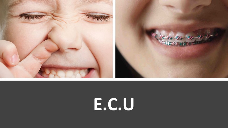 פריים דוגמה 4